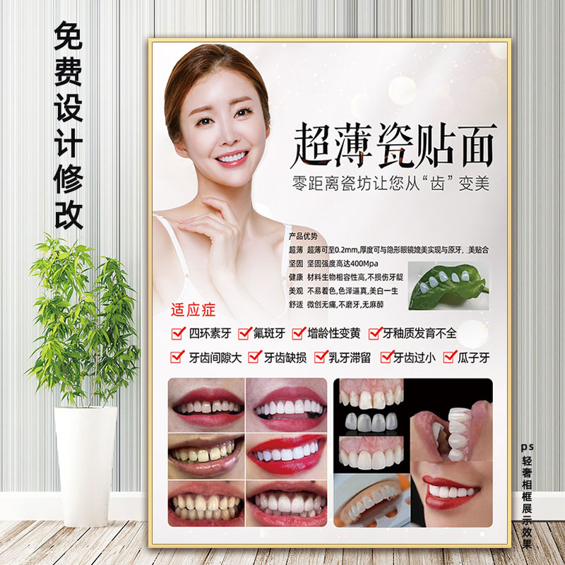 超薄全瓷贴面海报宣传画纳米冰瓷美牙广告医美墙壁画牙齿美白挂画